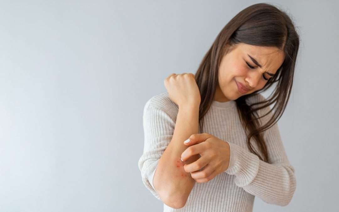 Preguntas frecuentes acerca del eczema en adultos: una dermatitis bastante común