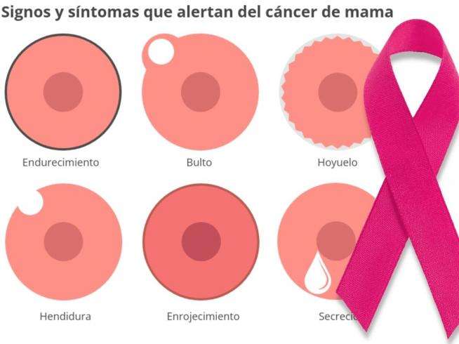 ¡Mujeres! Lo que deberías saber sobre los signos temprano del cáncer de mama