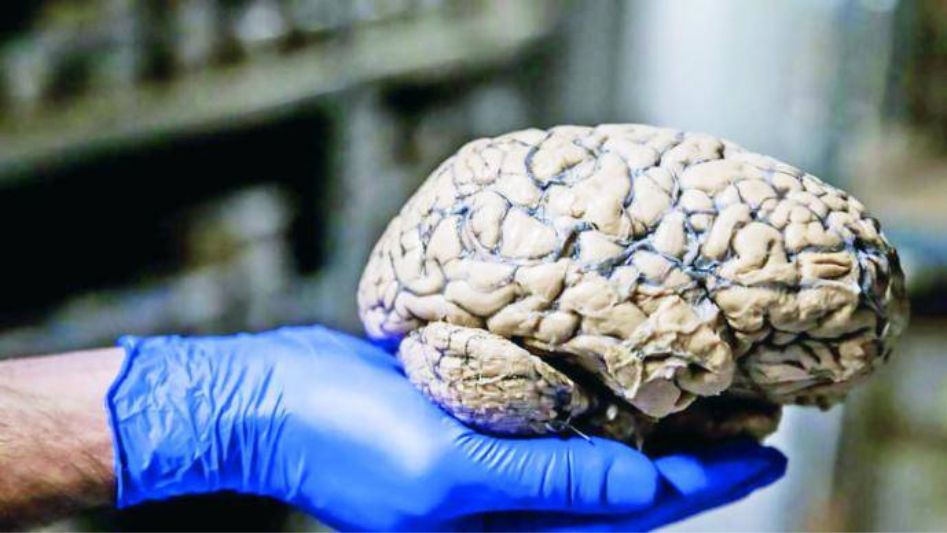 el cerebro humano pesa alrededor de 1,4 kilos
